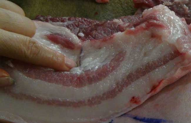 脾脏感染猪肉绦虫图片