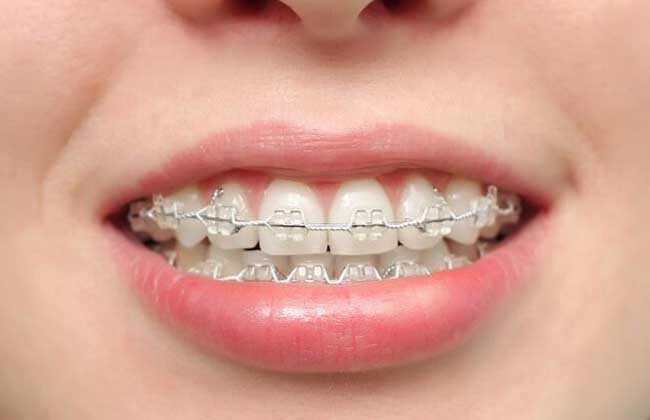 牙齿黄了怎么变白？