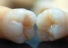 正常成年人有多少颗牙齿？