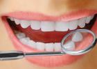 洗牙对牙齿有伤害吗？