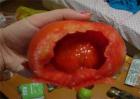 西红柿容易出现的病害
