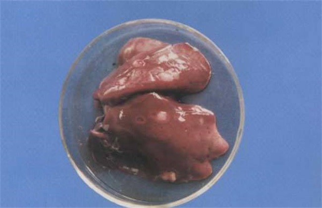 肝结核